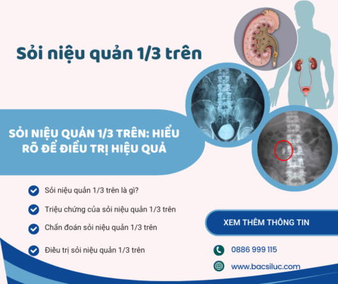 Sỏi niệu quản 1/3 trên: Hiểu rõ để điều trị hiệu quả